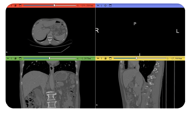 Original 2D medical scans