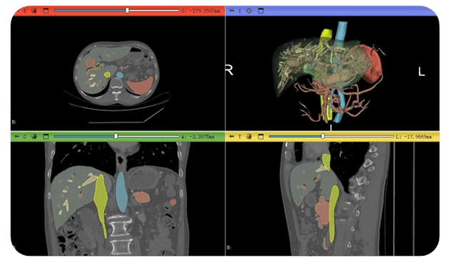 Labeled images and 3D reconstruction
