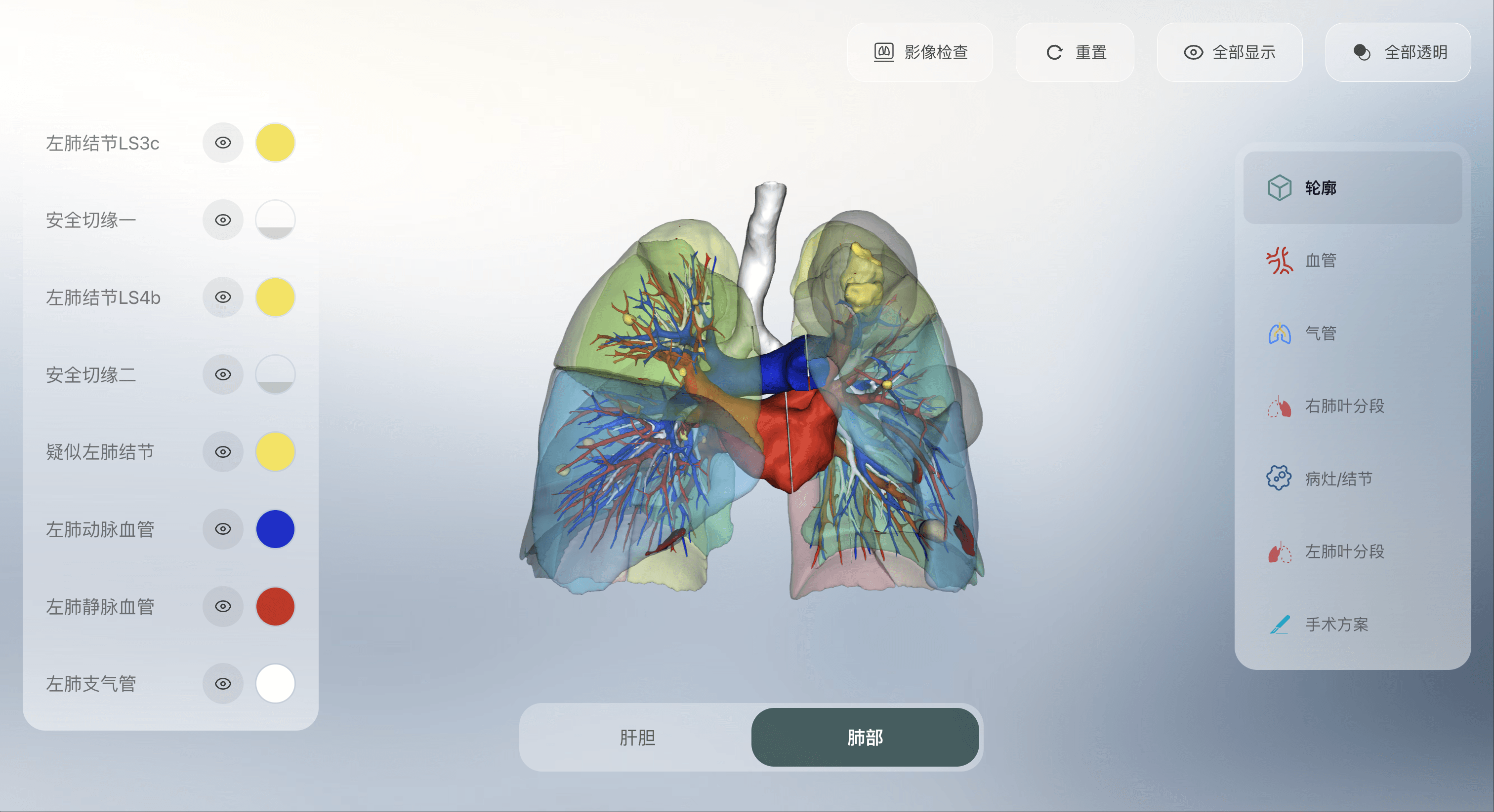 3D Medical Imaging